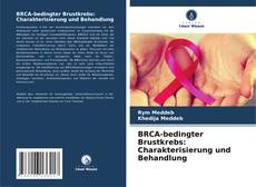 Bookcover of BRCA-bedingter Brustkrebs: Charakterisierung und Behandlung