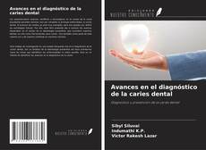 Buchcover von Avances en el diagnóstico de la caries dental