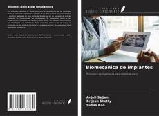 Buchcover von Biomecánica de implantes