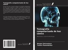 Tomografía computarizada de haz cónico kitap kapağı