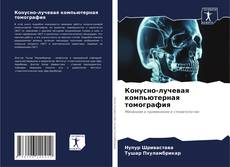 Bookcover of Конусно-лучевая компьютерная томография
