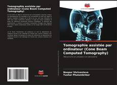 Portada del libro de Tomographie assistée par ordinateur (Cone Beam Computed Tomography)