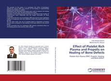 Buchcover von Effect of Platelet Rich Plasma and Propolis on Healing of Bone Defects