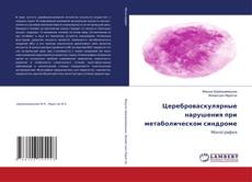 Portada del libro de Цереброваскулярные нарушения при метаболическом синдроме