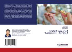 Buchcover von Implant Supported Overdentures - Revisited