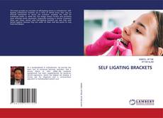SELF LIGATING BRACKETS的封面