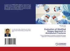 Copertina di Evaluation of Modified Stoppa Approach in Acetabulum Fractures