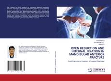 OPEN REDUCTION AND INTERNAL FIXATION IN MANDIBULAR ANTERIOR FRACTURE的封面