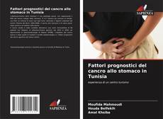 Couverture de Fattori prognostici del cancro allo stomaco in Tunisia
