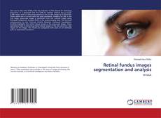 Retinal fundus images segmentation and analysis kitap kapağı