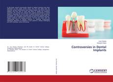 Buchcover von Controversies in Dental Implants