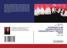 Buchcover von INTRARADICULAR REHABILITATION OF ENDODONTICALLY TREATED TEETH