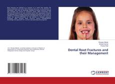 Buchcover von Dental Root Fractures and their Management