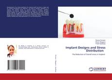 Copertina di Implant Designs and Stress Distribution