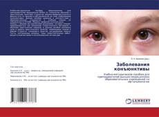 Capa do livro de Заболевания конъюнктивы 