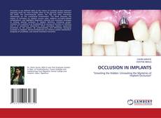 Capa do livro de OCCLUSION IN IMPLANTS 