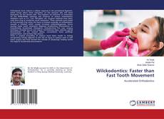 Couverture de Wilckodontics: Faster than Fast Tooth Movement