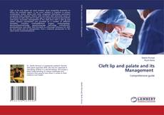 Capa do livro de Cleft lip and palate and its Management 
