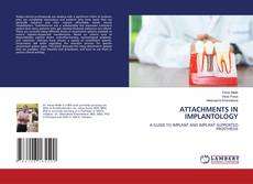 Capa do livro de ATTACHMENTS IN IMPLANTOLOGY 