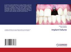 Capa do livro de Implant Failures 