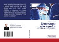 Buchcover von Хирургическое лечение острой непроходимости сигмовидной кишки