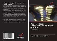 Borítókép a  Poziom wiedzy społeczeństwa na temat gruźlicy - hoz