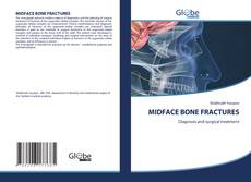 Copertina di MIDFACE BONE FRACTURES