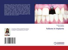 Capa do livro de Failures in Implants 