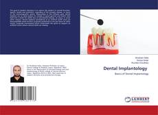 Capa do livro de Dental Implantology 