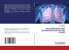 Couverture de PECILOMYCOSIS AND ECHINOCOCCOSIS OF THE LUNGS