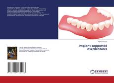 Couverture de Implant supported overdentures