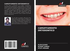 Bookcover of CAMUFFAMENTO ORTODONTICO