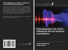 Bookcover of Osiculoplastia con éxito: influencia de los factores pronósticos