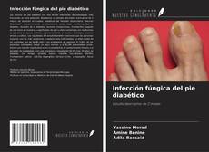 Bookcover of Infección fúngica del pie diabético