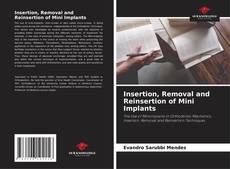 Обложка Insertion, Removal and Reinsertion of Mini Implants