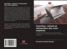 Buchcover von Insertion, retrait et réinsertion des mini-implants