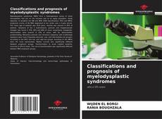 Buchcover von Classifications and prognosis of myelodysplastic syndromes