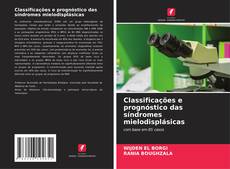 Buchcover von Classificações e prognóstico das síndromes mielodisplásicas
