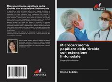 Bookcover of Microcarcinoma papillare della tiroide con estensione linfonodale