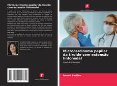 Bookcover of Microcarcinoma papilar da tiroide com extensão linfonodal