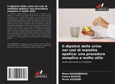 Bookcover of Il dipstick delle urine nei casi di malattia epatica: una procedura semplice e molto utile