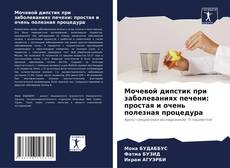 Borítókép a  Мочевой дипстик при заболеваниях печени: простая и очень полезная процедура - hoz