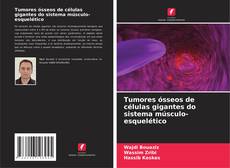 Bookcover of Tumores ósseos de células gigantes do sistema músculo-esquelético