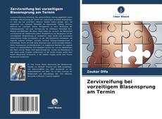 Portada del libro de Zervixreifung bei vorzeitigem Blasensprung am Termin