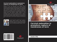 Bookcover of Cervical maturation in premature rupture of membranes at term