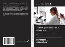 Buchcover von Lesiones queratósicas de la cavidad oral