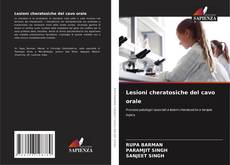 Bookcover of Lesioni cheratosiche del cavo orale