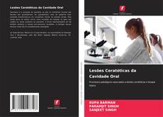 Buchcover von Lesões Ceratóticas da Cavidade Oral