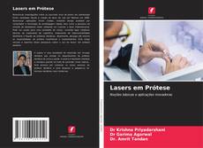 Buchcover von Lasers em Prótese