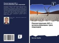 Обложка Реконструкция ACL с использованием трех подходов